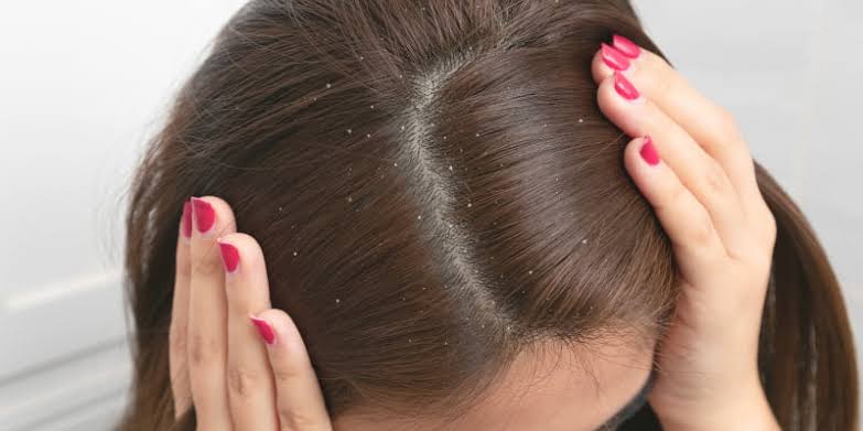 SCALP BALANCE